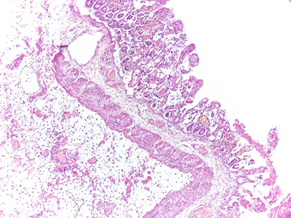 FOTO 4: Piccolo intestino. Intenso edema a livello della sottomucosa, lamina propria e villi, congestione dei vasi ematici e necrosi dei villi (20x, ematossilina-eosina). Foto IZSLER.